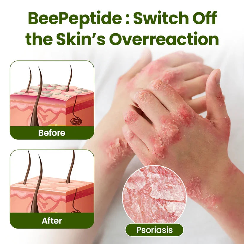 BeePeptide RootSoft DualRelief Cream
