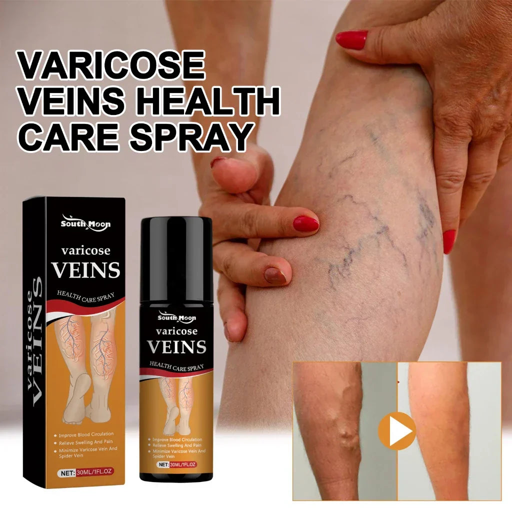 Turmeric Vericose Vein Relief Spray